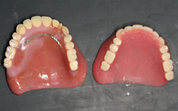 左の旧義歯の排列はかなりバランスが良くないことがわかる。