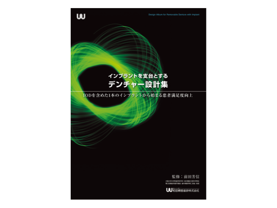 インプラントを支台とするデンチャー設計集