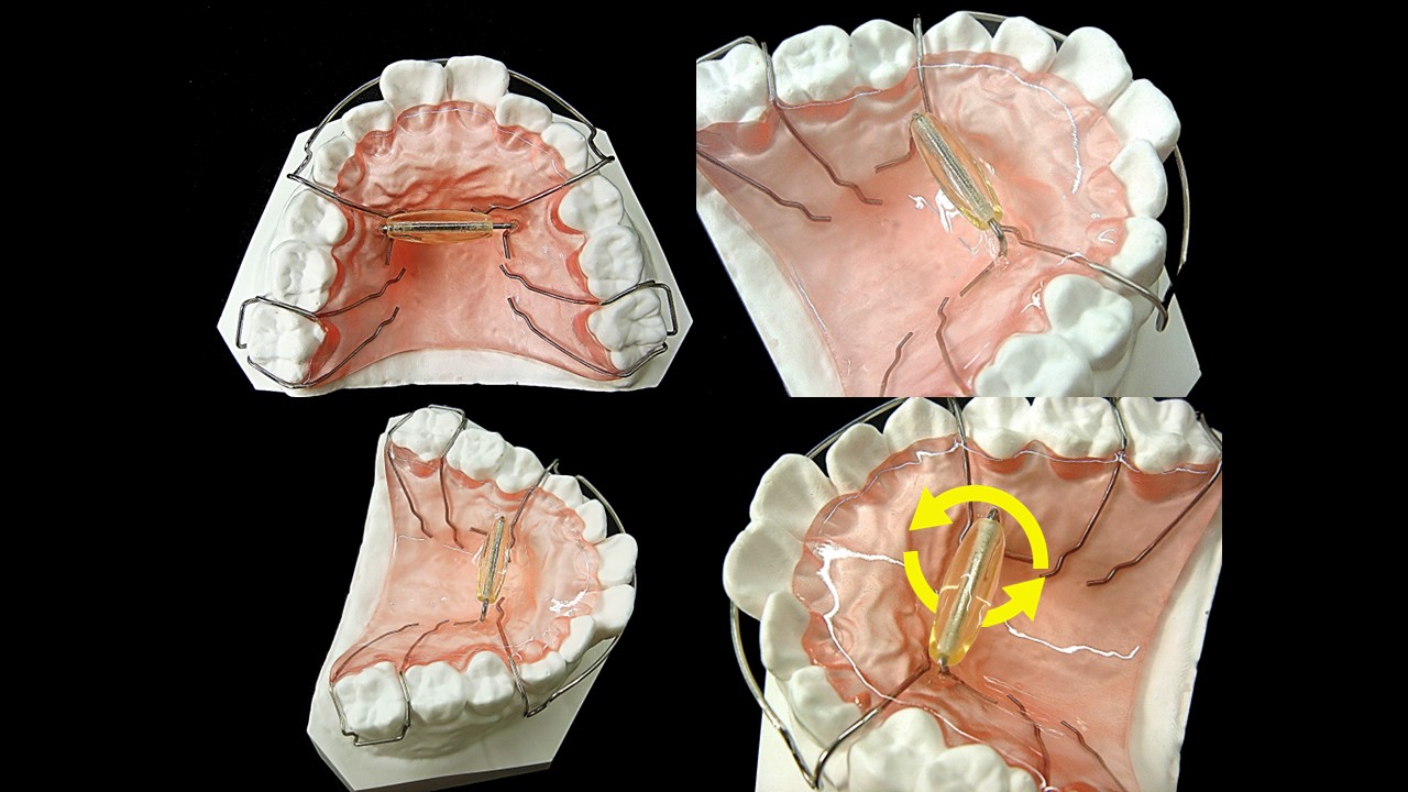 コロコロプレート