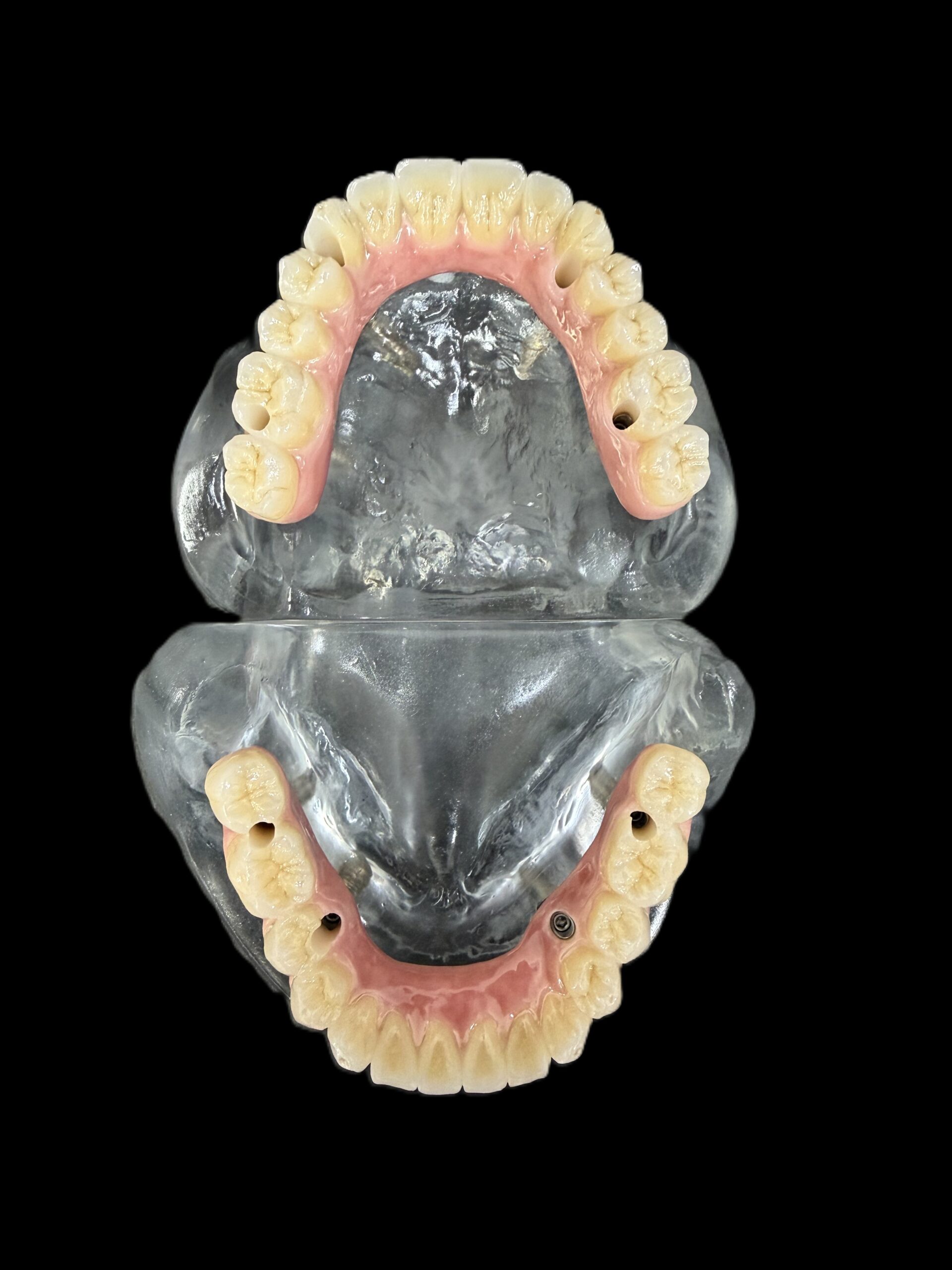 歯科技工士になってよかったと思う瞬間、エピソード